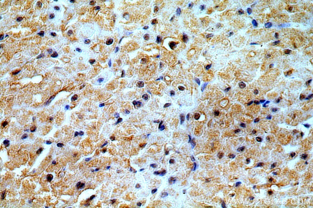 Immunohistochemistry (IHC) staining of human heart tissue using PRICKLE3 Polyclonal antibody (19098-1-AP)