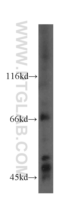 Western Blot (WB) analysis of HeLa cells using PRICKLE3 Polyclonal antibody (19098-1-AP)