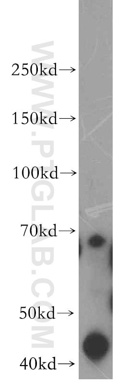Western Blot (WB) analysis of Jurkat cells using PRICKLE3 Polyclonal antibody (19098-1-AP)