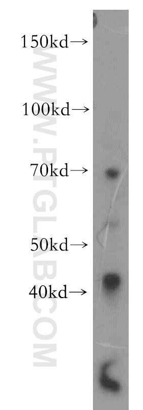 Western Blot (WB) analysis of Jurkat cells using PRICKLE3 Polyclonal antibody (19098-1-AP)