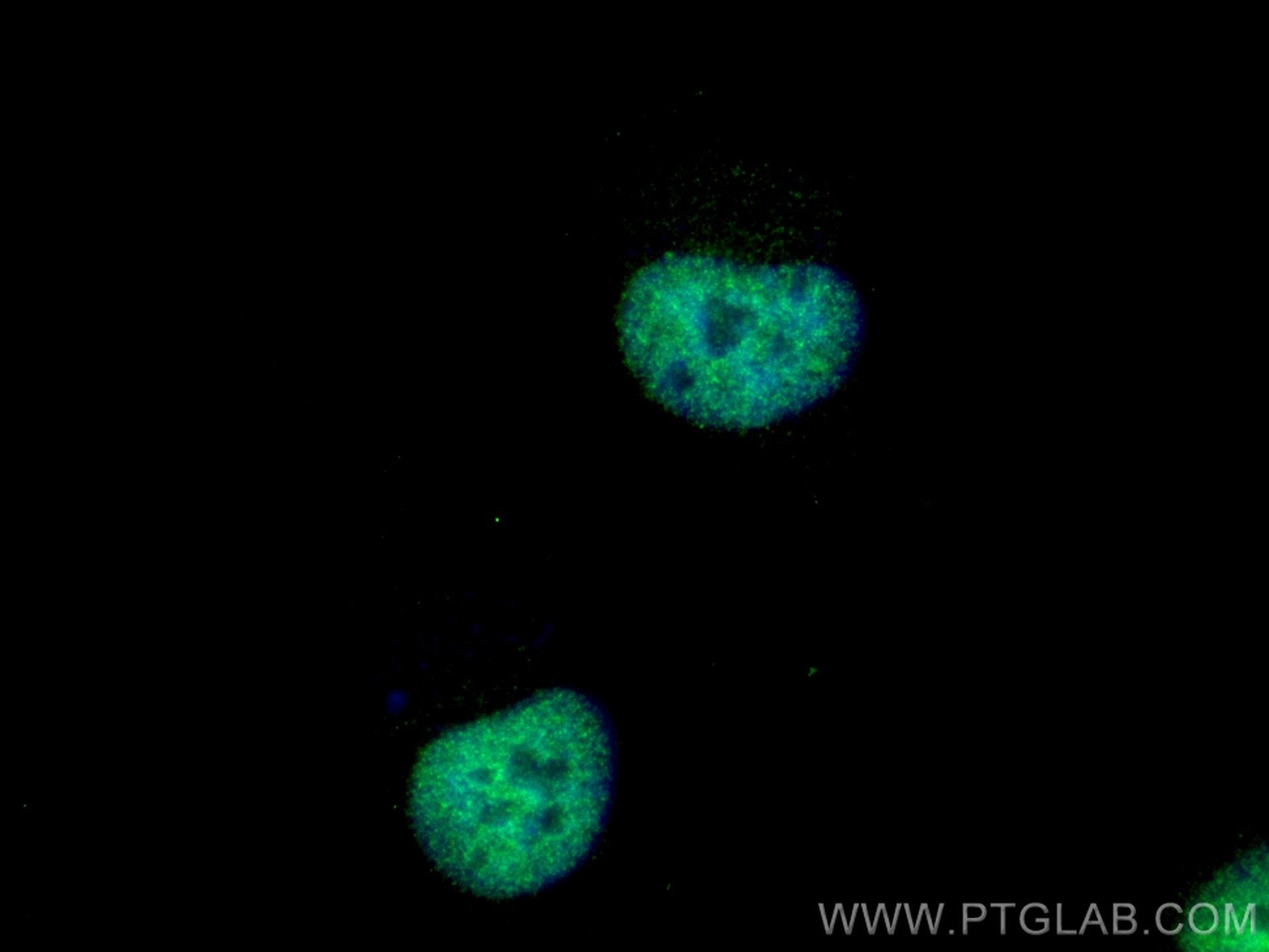 Immunofluorescence (IF) / fluorescent staining of HeLa cells using PRIM1 Polyclonal antibody (10773-1-AP)