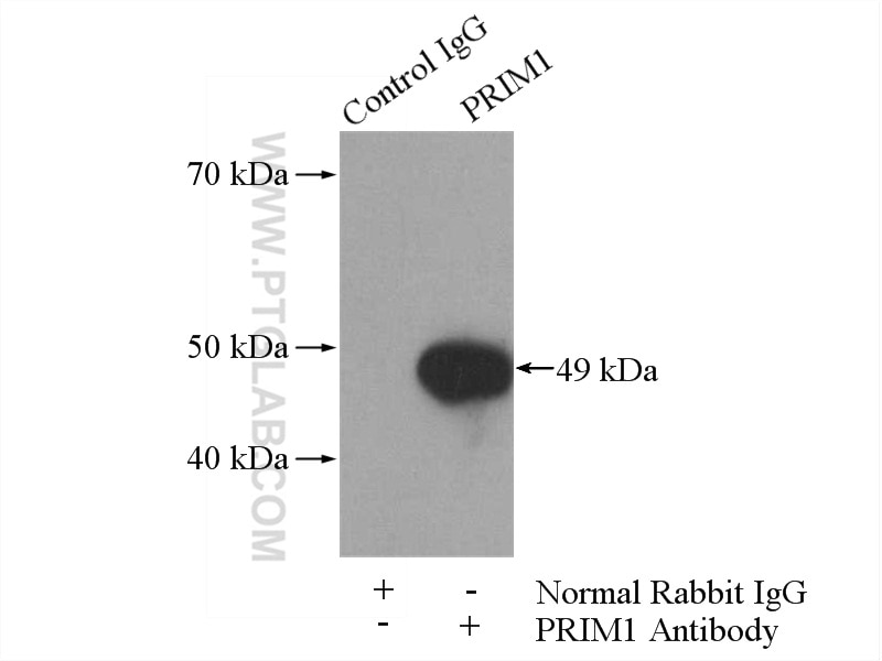 Immunoprecipitation (IP) experiment of HeLa cells using PRIM1 Polyclonal antibody (10773-1-AP)
