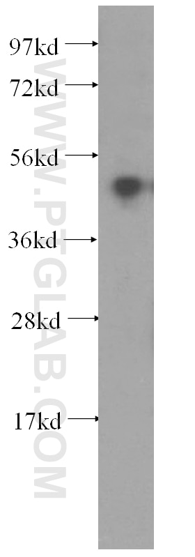 WB analysis of K-562 using 10773-1-AP