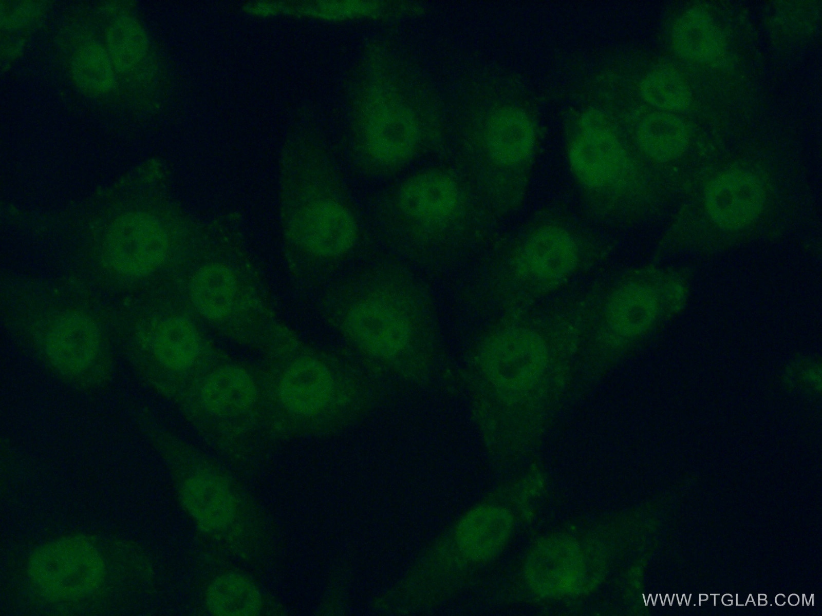 Immunofluorescence (IF) / fluorescent staining of A375 cells using PRIM2 Polyclonal antibody (11788-1-AP)