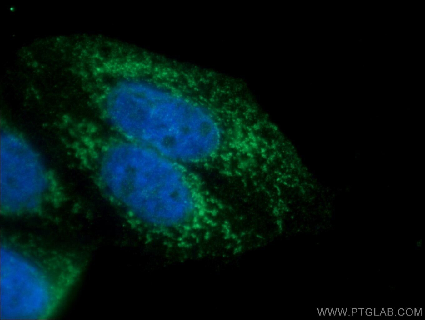 AMPK Alpha Polyclonal antibody