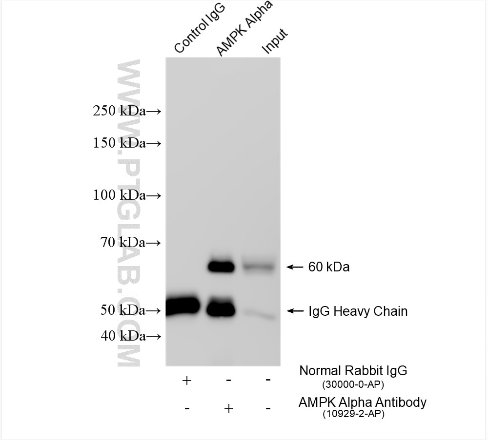Immunoprecipitation (IP) experiment of HeLa cells using human AMPK Alpha Polyclonal antibody (10929-2-AP)