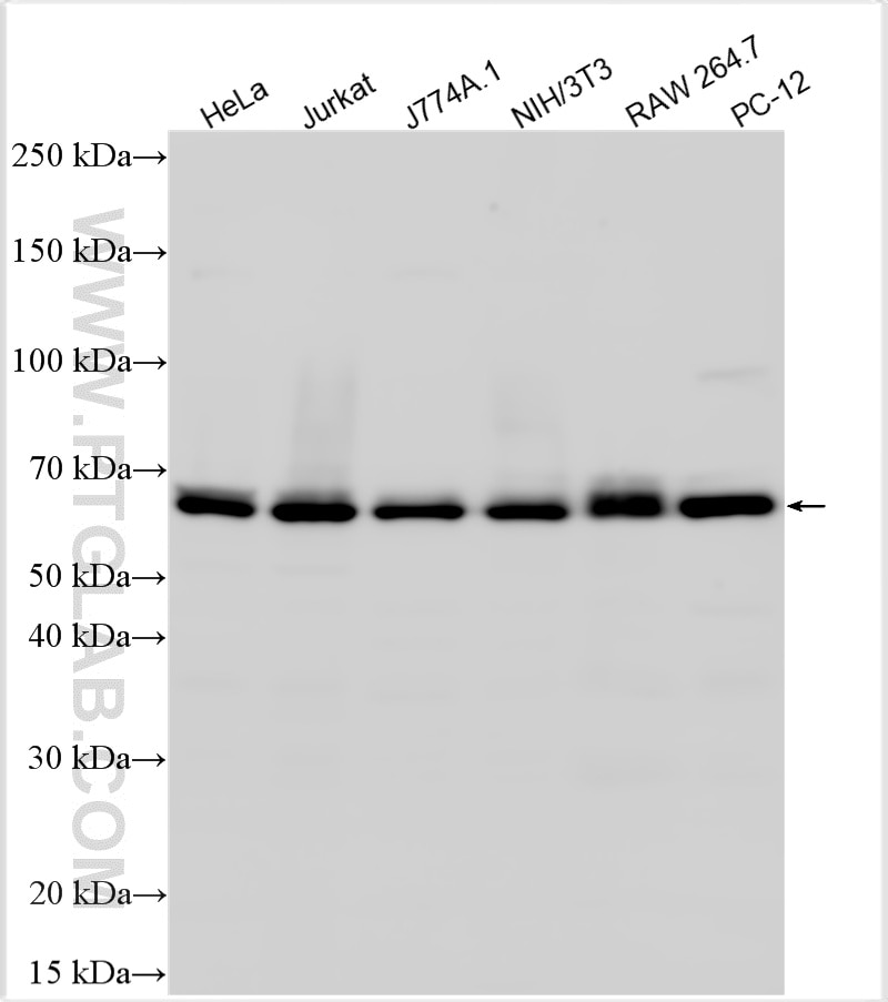Western Blot (WB) analysis of various lysates using AMPK Alpha Polyclonal antibody (10929-2-AP)