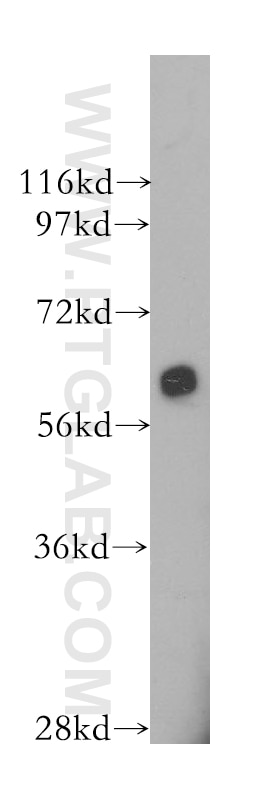 AMPK Alpha Polyclonal antibody