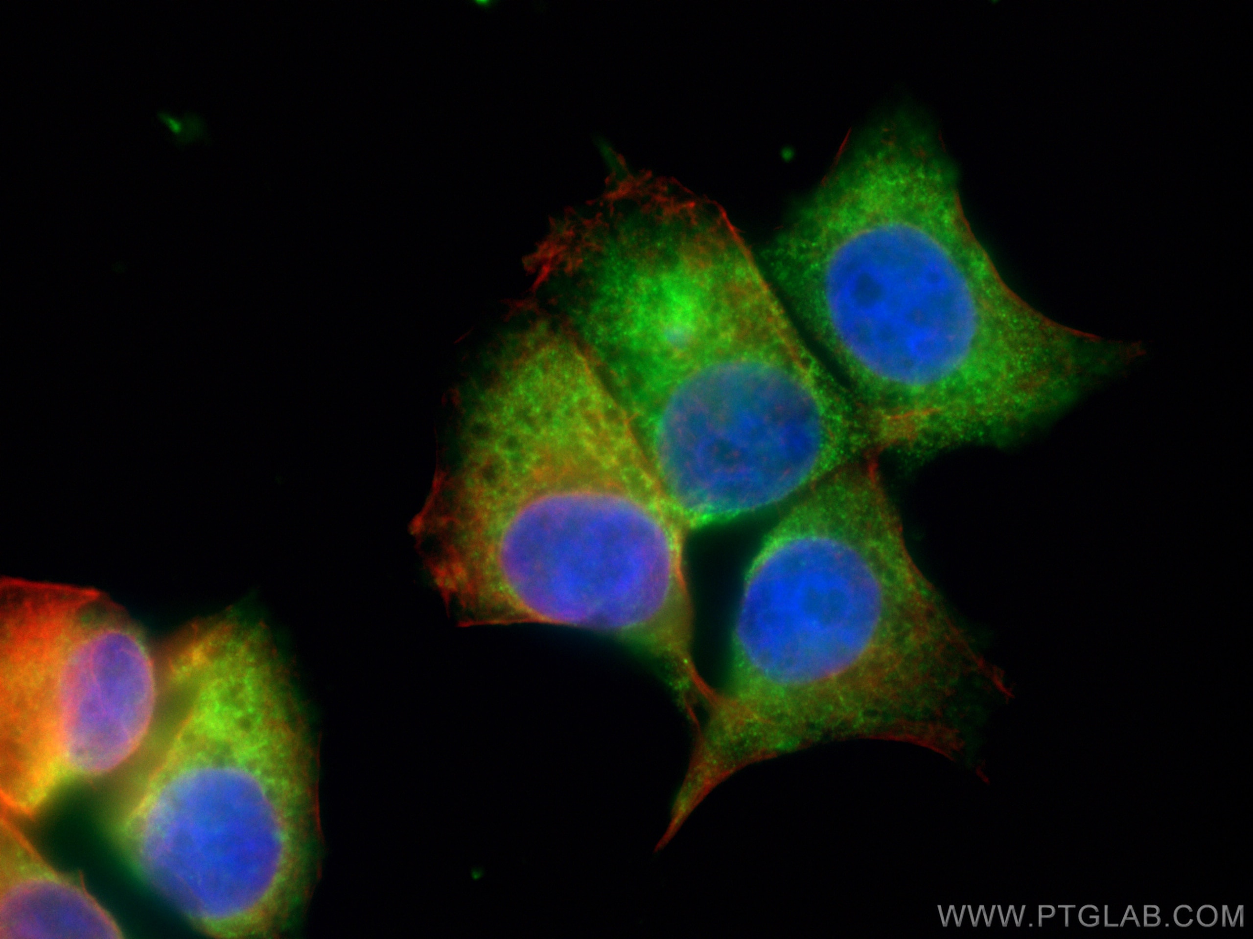 Immunofluorescence (IF) / fluorescent staining of MCF-7 cells using AMPK Alpha 2 Polyclonal antibody (18167-1-AP)