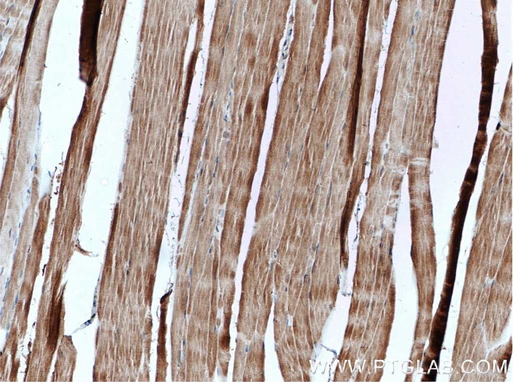 Immunohistochemistry (IHC) staining of mouse skeletal muscle tissue using AMPK Alpha 2 Polyclonal antibody (18167-1-AP)