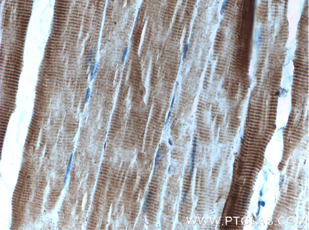 Immunohistochemistry (IHC) staining of mouse skeletal muscle tissue using AMPK Alpha 2 Polyclonal antibody (18167-1-AP)