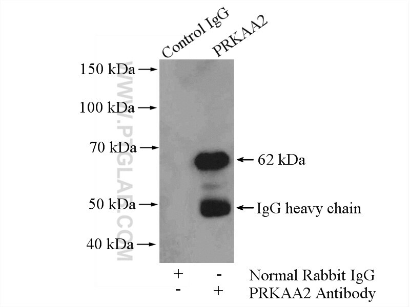 IP experiment of mouse skeletal muscle using 18167-1-AP