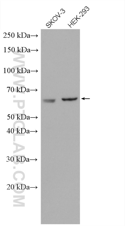 Western Blot (WB) analysis of various lysates using AMPK Alpha 2 Polyclonal antibody (18167-1-AP)