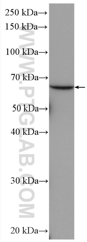 Western Blot (WB) analysis of HEK-293 cells using AMPK Alpha 2 Polyclonal antibody (18167-1-AP)