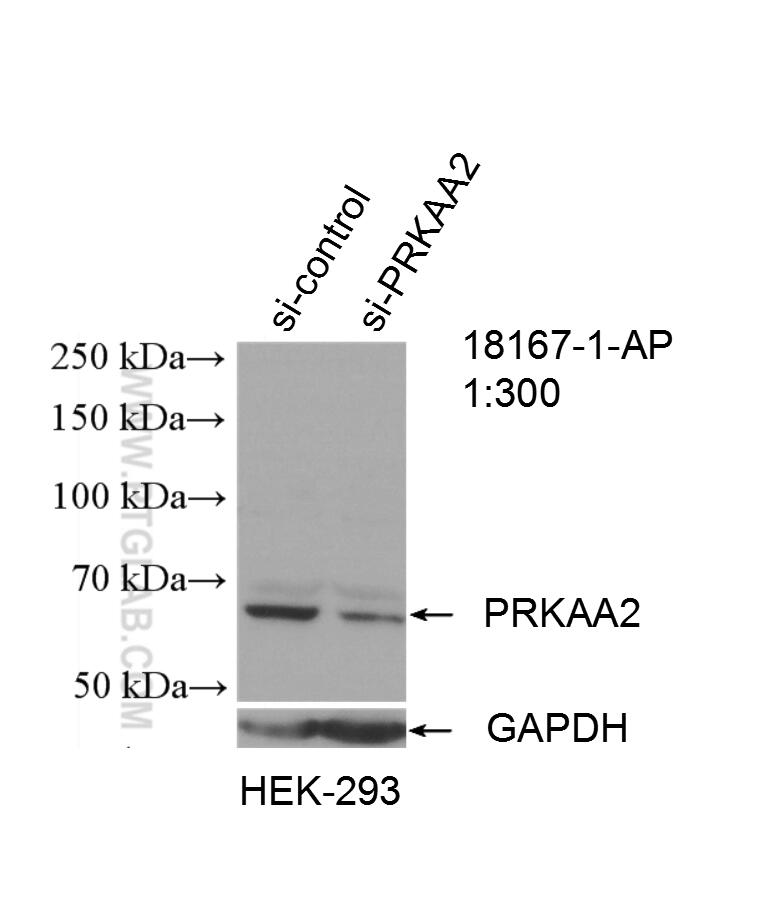 Western Blot (WB) analysis of HEK-293 cells using AMPK Alpha 2 Polyclonal antibody (18167-1-AP)