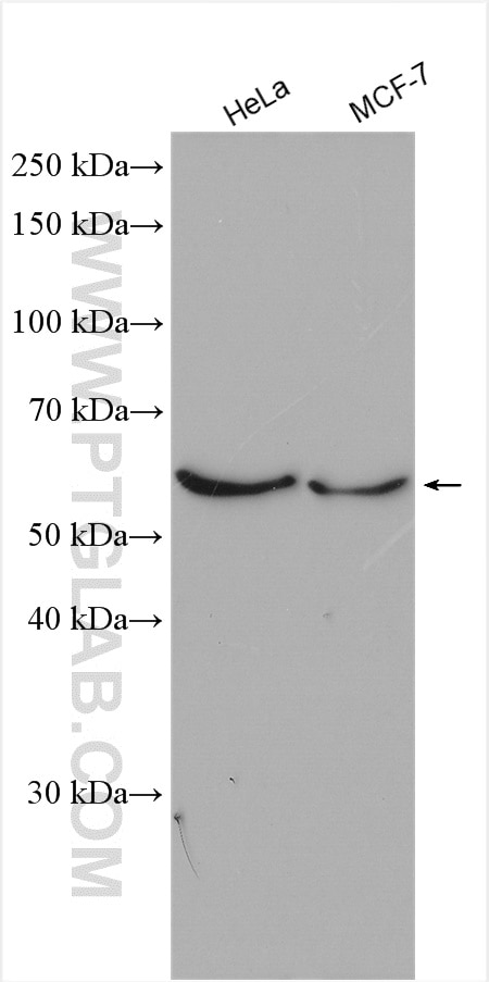 Western Blot (WB) analysis of various lysates using AMPK Alpha 2 Polyclonal antibody (18167-1-AP)