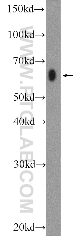 Western Blot (WB) analysis of rat ovary tissue using AMPK Alpha 2 Polyclonal antibody (18167-1-AP)