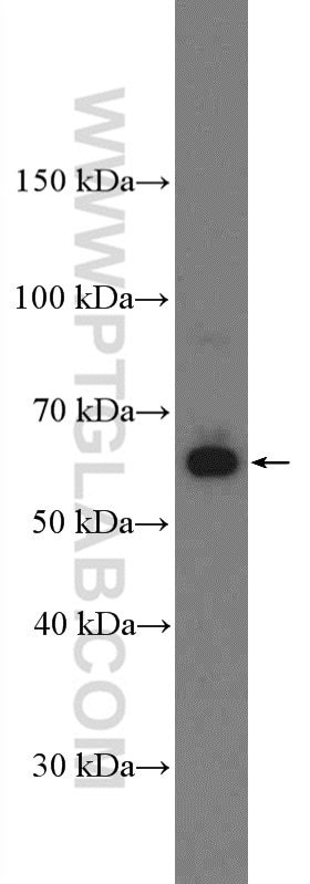Western Blot (WB) analysis of HEK-293 cells using AMPK Alpha 2 Polyclonal antibody (18167-1-AP)