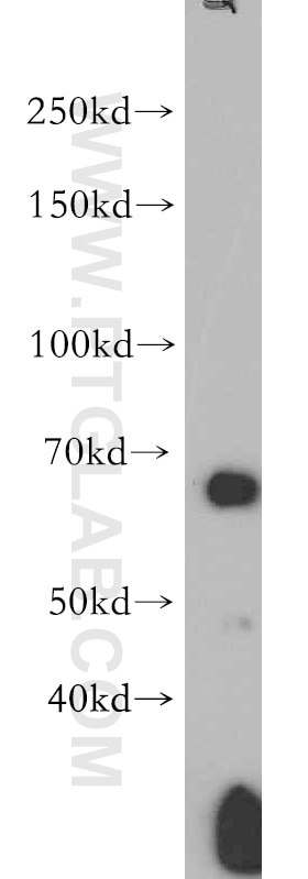 Western Blot (WB) analysis of human skeletal muscle tissue using AMPK Alpha 2 Polyclonal antibody (18167-1-AP)