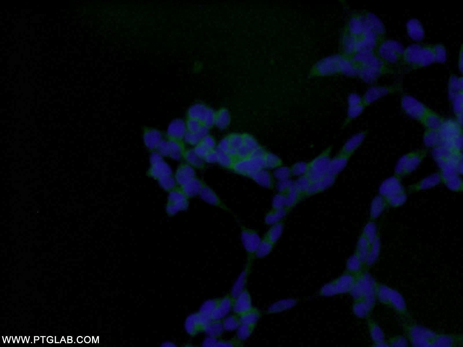Immunofluorescence (IF) / fluorescent staining of HEK-293 cells using AMPK Beta 1 Polyclonal antibody (10308-1-AP)