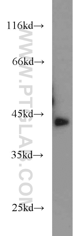 Western Blot (WB) analysis of A431 cells using AMPK Beta 1 Polyclonal antibody (10308-1-AP)