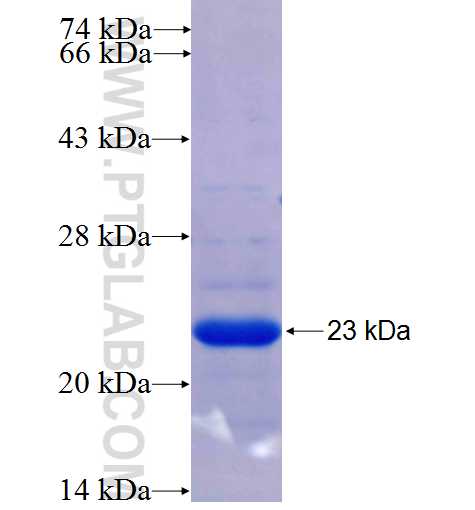 PRKAB1 fusion protein Ag25521 SDS-PAGE