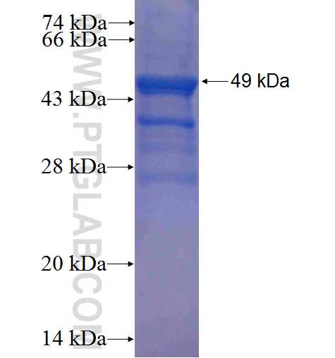 PRKAB1 fusion protein Ag0301 SDS-PAGE
