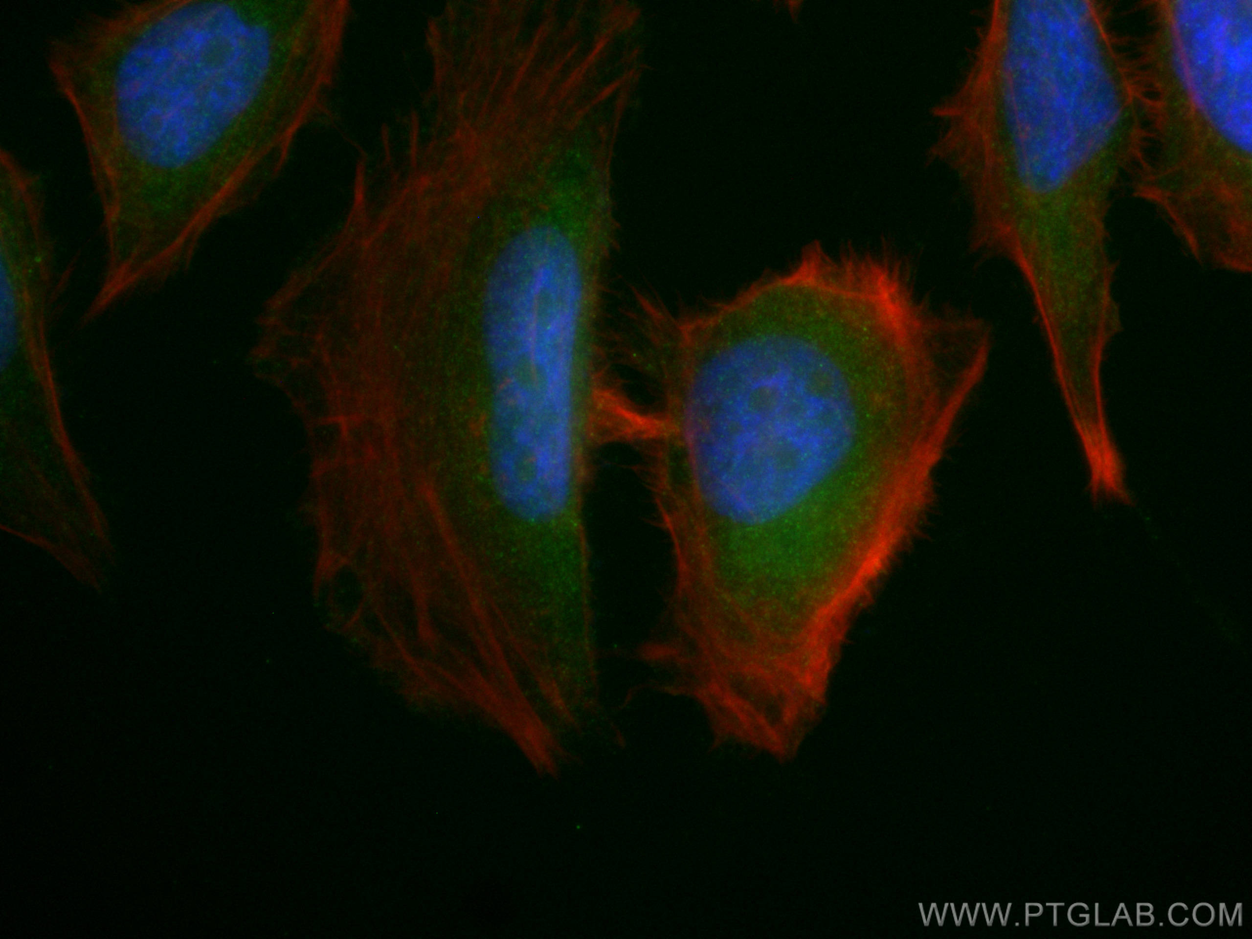 Immunofluorescence (IF) / fluorescent staining of HeLa cells using AMPK Beta 2 Polyclonal antibody (14429-1-AP)