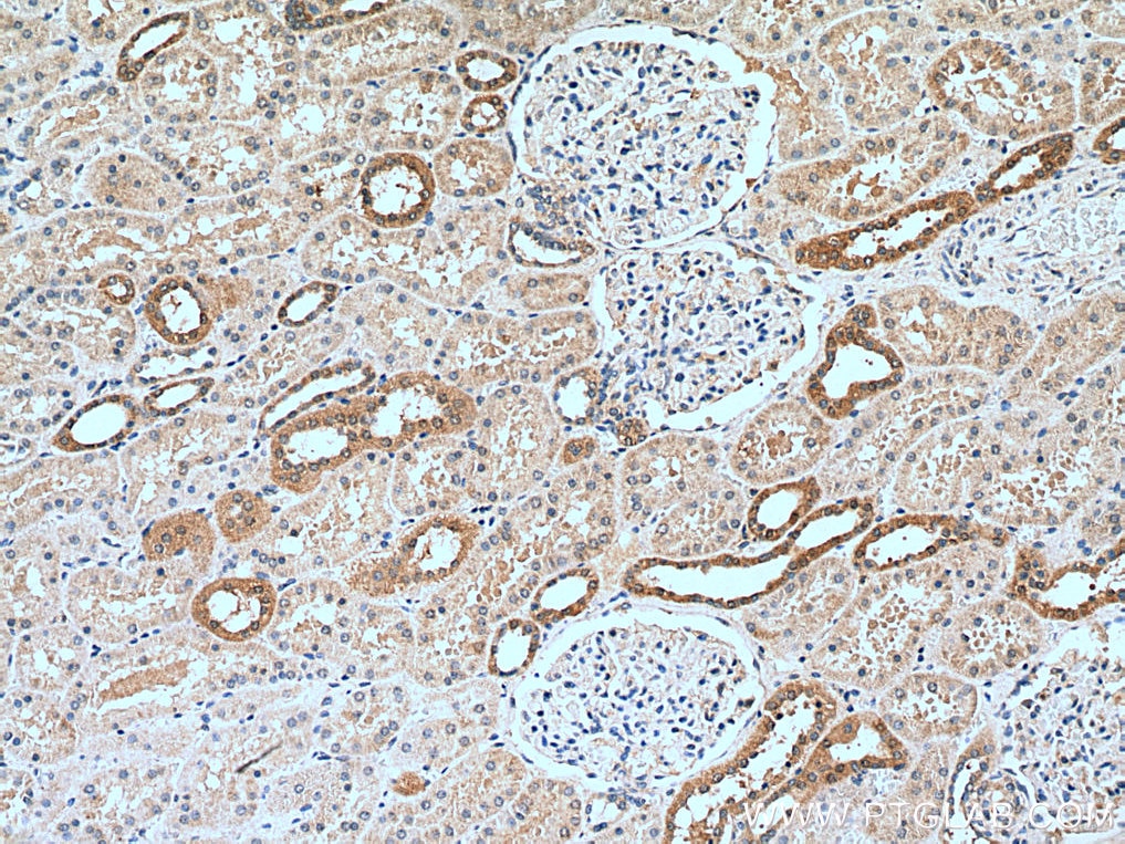 IHC staining of human kidney using 14429-1-AP