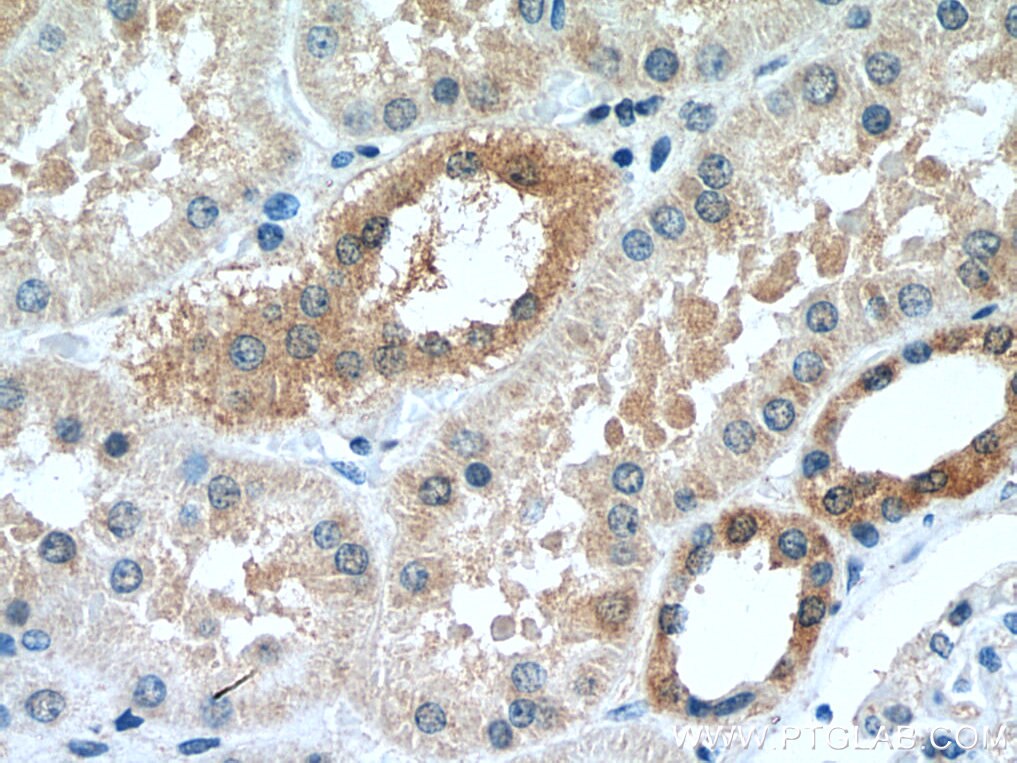 Immunohistochemistry (IHC) staining of human kidney tissue using AMPK Beta 2 Polyclonal antibody (14429-1-AP)