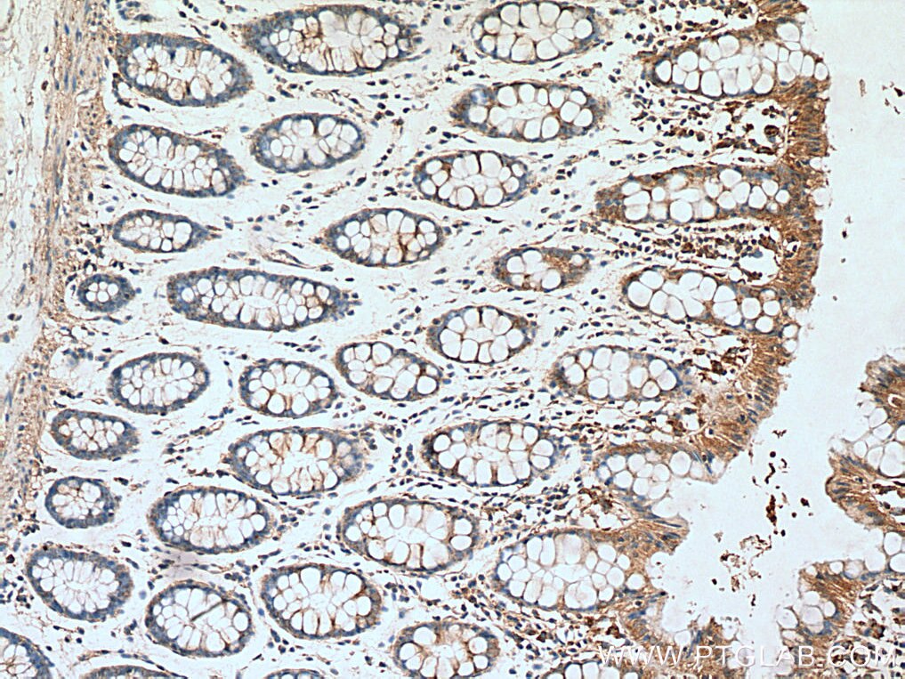 Immunohistochemistry (IHC) staining of human colon tissue using AMPK Beta 2 Polyclonal antibody (14429-1-AP)