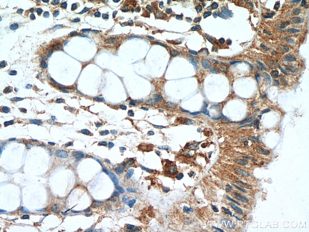Immunohistochemistry (IHC) staining of human colon tissue using AMPK Beta 2 Polyclonal antibody (14429-1-AP)