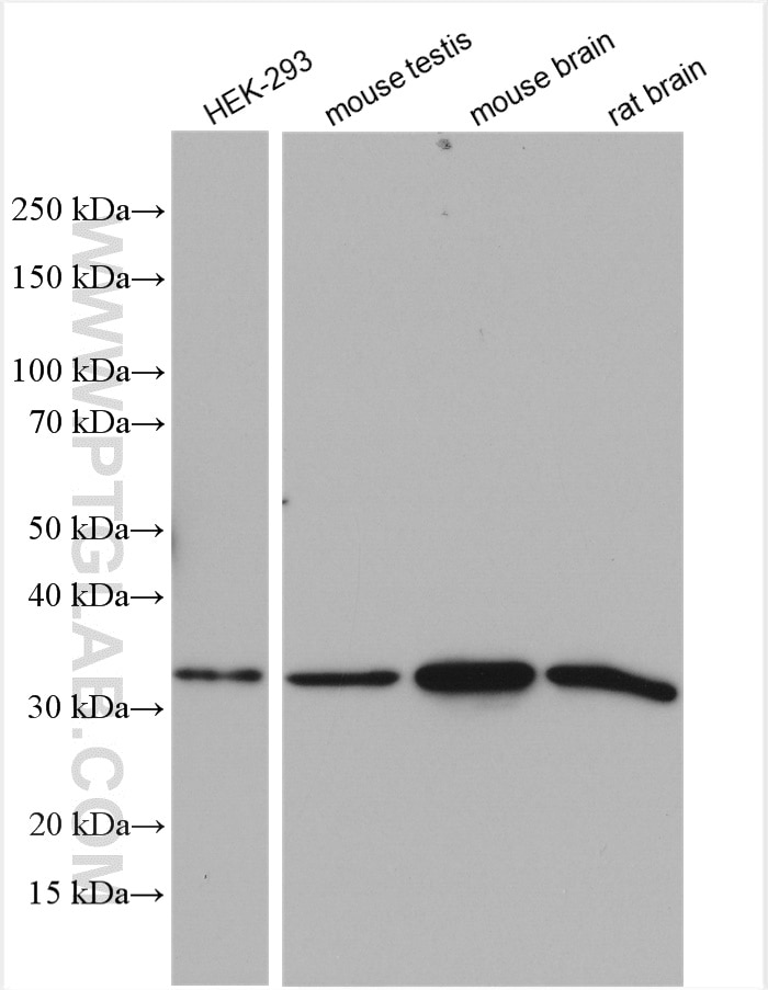 Western Blot (WB) analysis of various lysates using AMPK Beta 2 Polyclonal antibody (14429-1-AP)