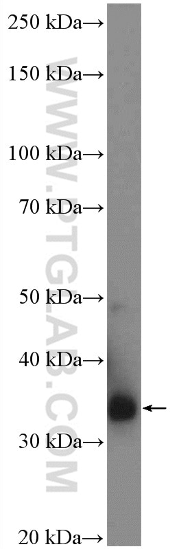 WB analysis of fetal human brain using 14429-1-AP