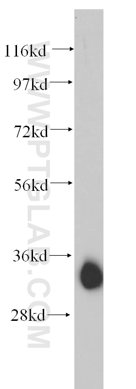 WB analysis of human heart using 14429-1-AP