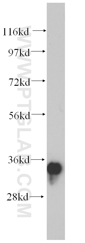 Western Blot (WB) analysis of human brain tissue using AMPK Beta 2 Polyclonal antibody (14429-1-AP)