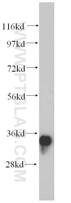 WB analysis of human brain using 14429-1-AP