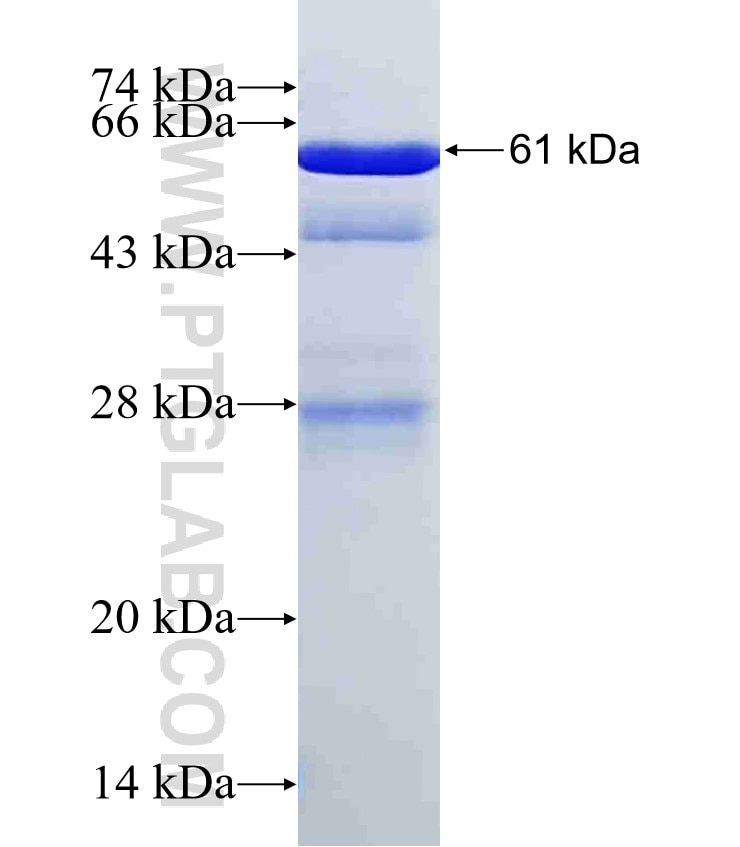 PRKAB2 fusion protein Ag5806 SDS-PAGE