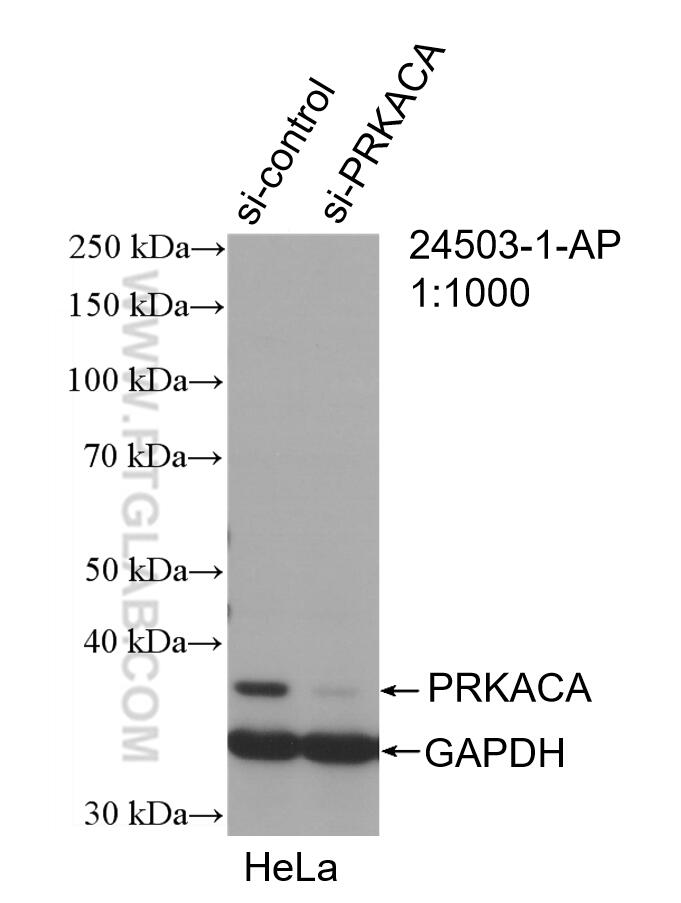 Western Blot (WB) analysis of HeLa cells using PRKACA Polyclonal antibody (24503-1-AP)