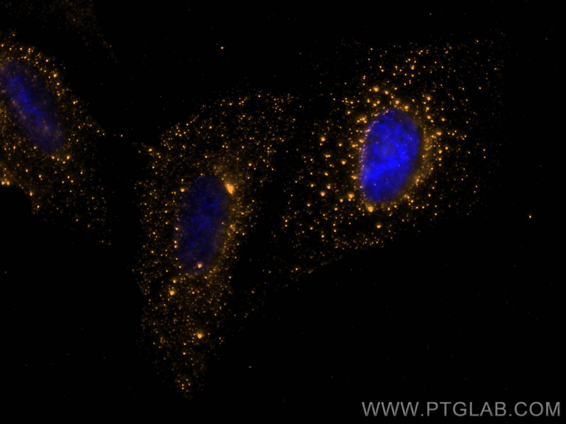 Immunofluorescence (IF) / fluorescent staining of U2OS cells using PRKACA Polyclonal antibody (27398-1-AP)
