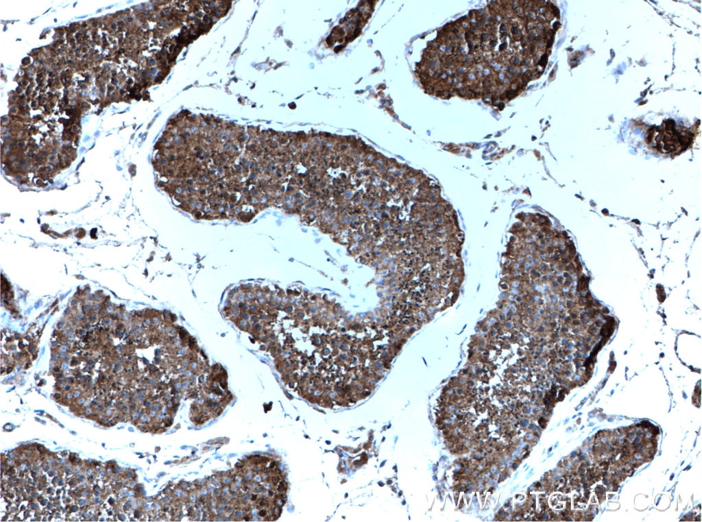 Immunohistochemistry (IHC) staining of human testis tissue using PRKACA Polyclonal antibody (27398-1-AP)
