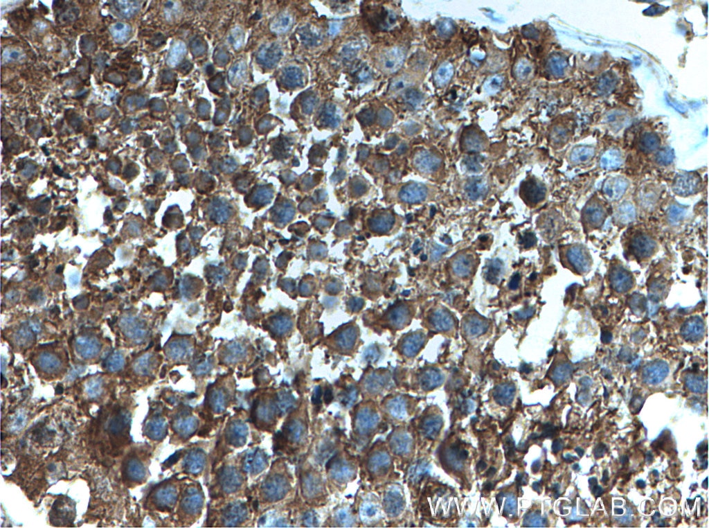 Immunohistochemistry (IHC) staining of human testis tissue using PRKACA Polyclonal antibody (27398-1-AP)