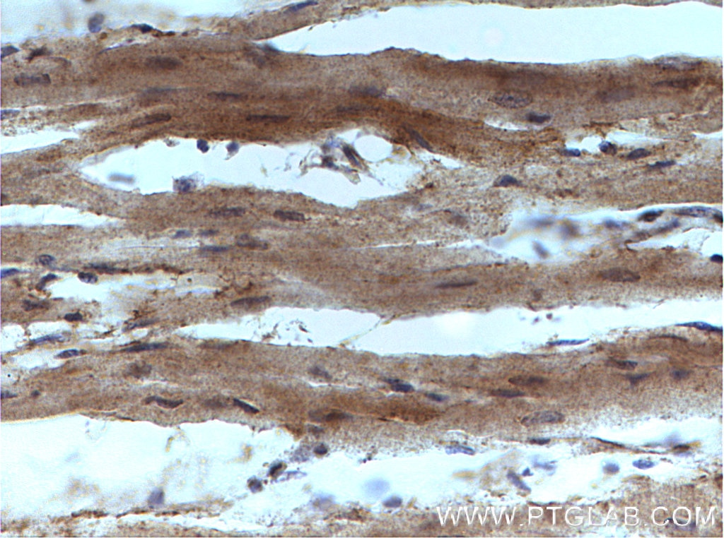 Immunohistochemistry (IHC) staining of human heart tissue using PRKACA Polyclonal antibody (27398-1-AP)