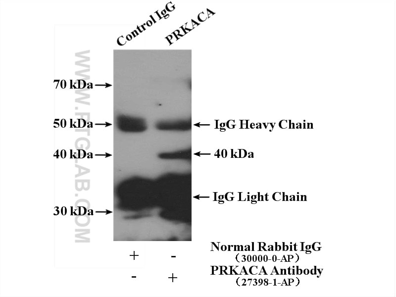 Immunoprecipitation (IP) experiment of HeLa cells using PRKACA Polyclonal antibody (27398-1-AP)