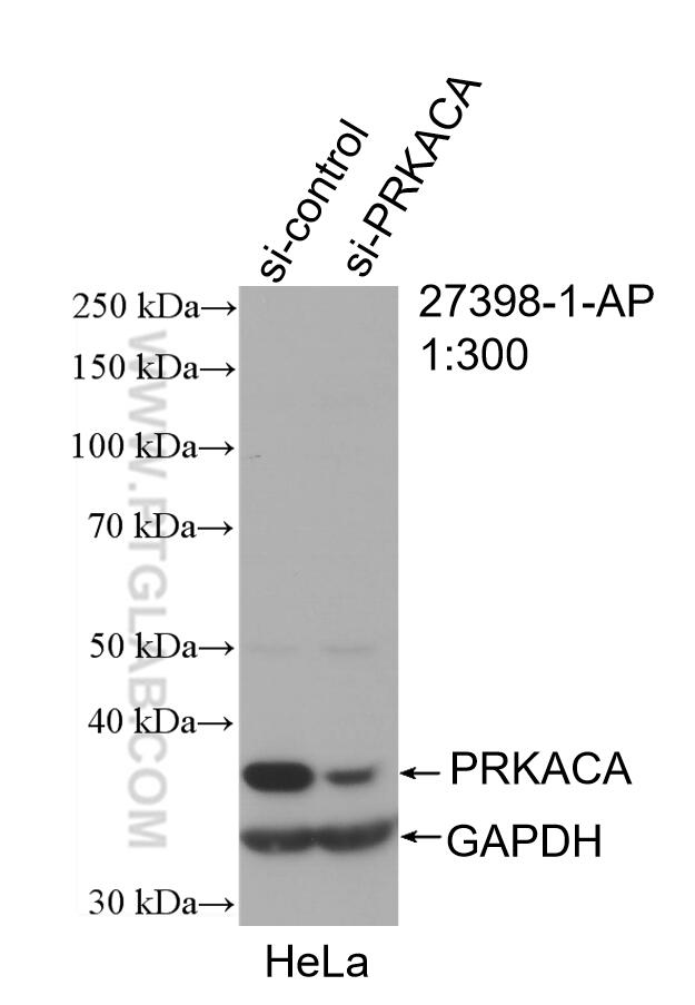 Western Blot (WB) analysis of HeLa cells using PRKACA Polyclonal antibody (27398-1-AP)