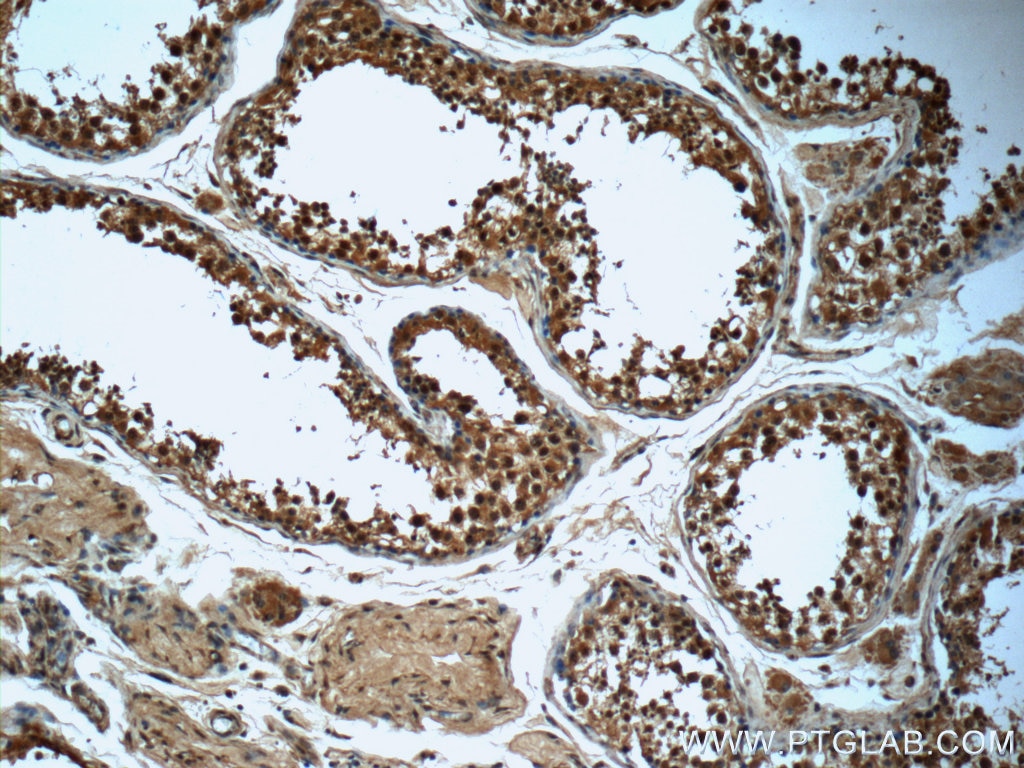 Immunohistochemistry (IHC) staining of human testis tissue using PKA C-alpha specific Polyclonal antibody (55388-1-AP)