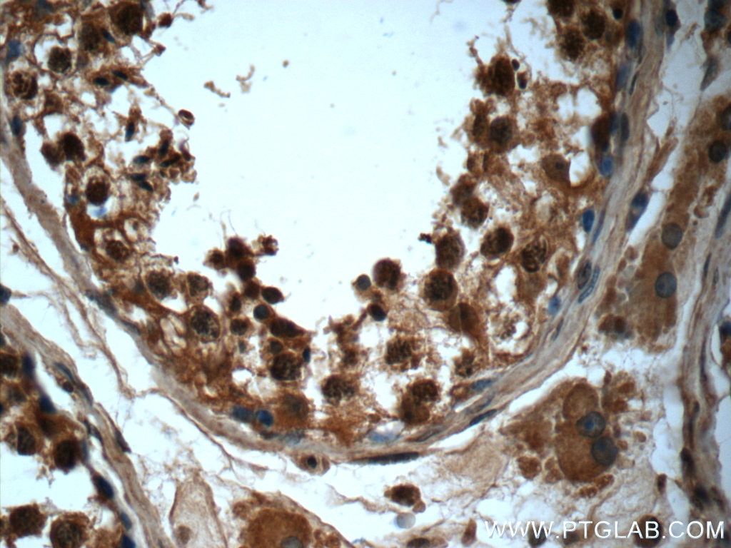 Immunohistochemistry (IHC) staining of human testis tissue using PKA C-alpha specific Polyclonal antibody (55388-1-AP)