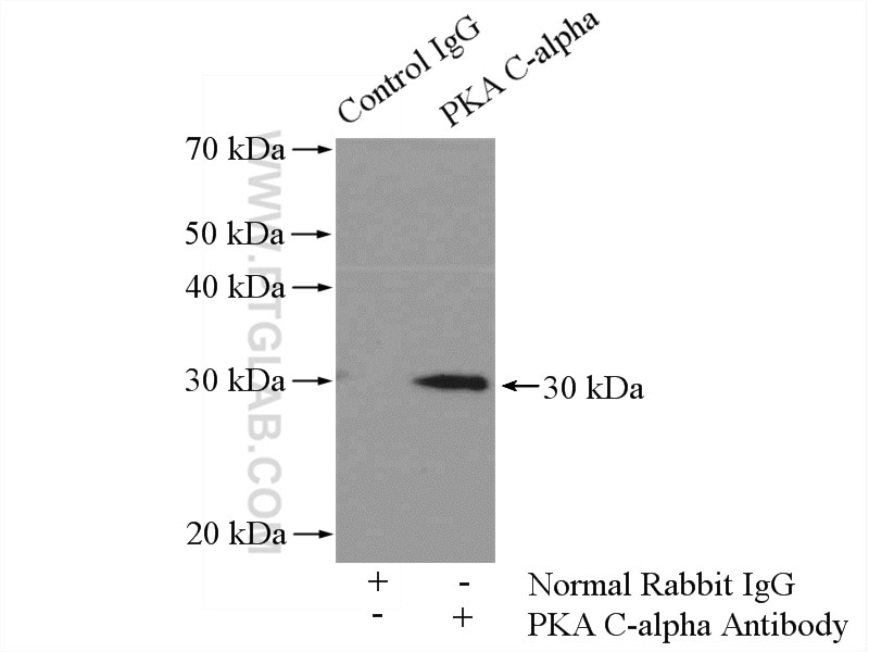 Immunoprecipitation (IP) experiment of mouse brain tissue using PKA C-alpha specific Polyclonal antibody (55388-1-AP)