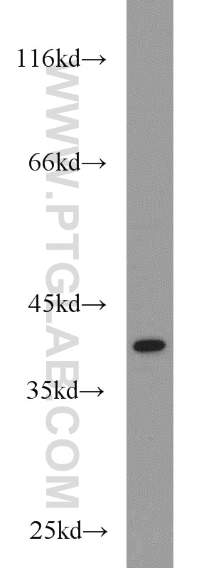 Western Blot (WB) analysis of human liver tissue using PKA C-alpha specific Polyclonal antibody (55388-1-AP)