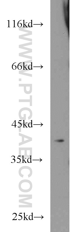 Western Blot (WB) analysis of human liver tissue using PKA C-alpha specific Polyclonal antibody (55388-1-AP)